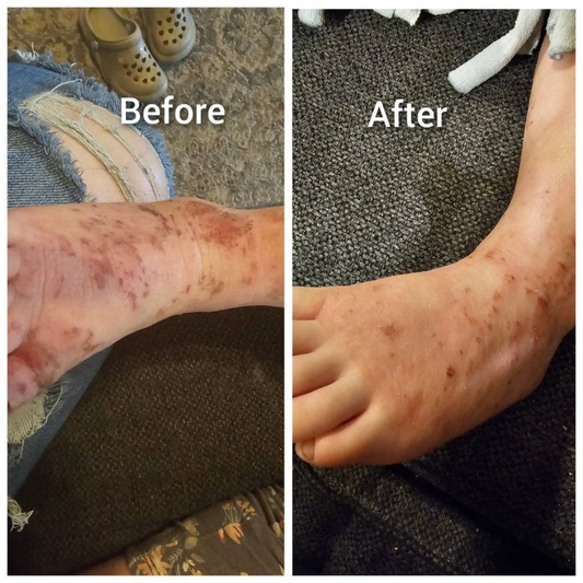 Crème Fouettée Neem Moringa